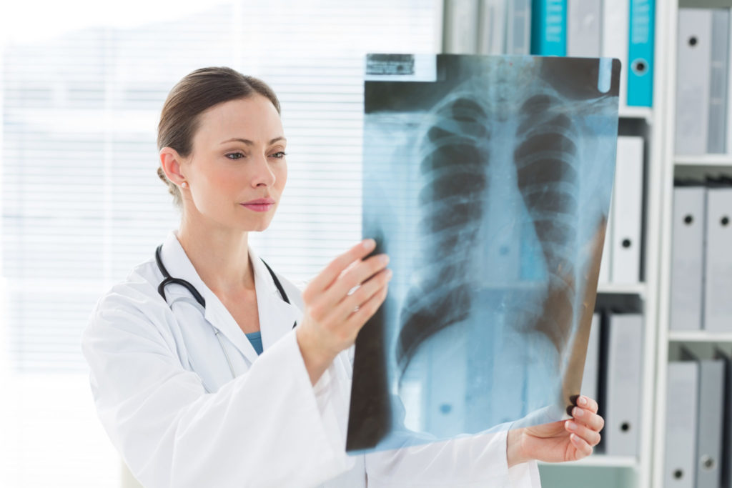 Signs of Medical Negligence in Radiology - The Snyder Law Group, LLC